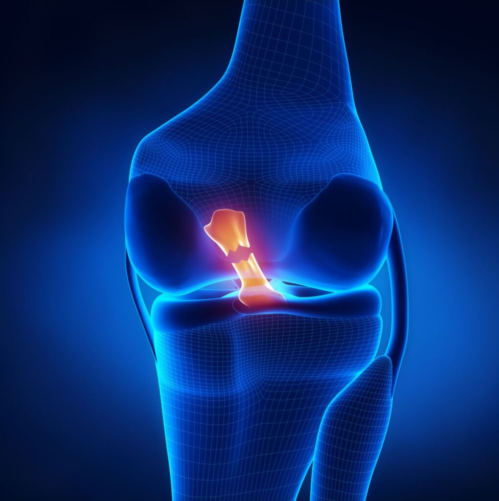 Medical Illustration: Knee