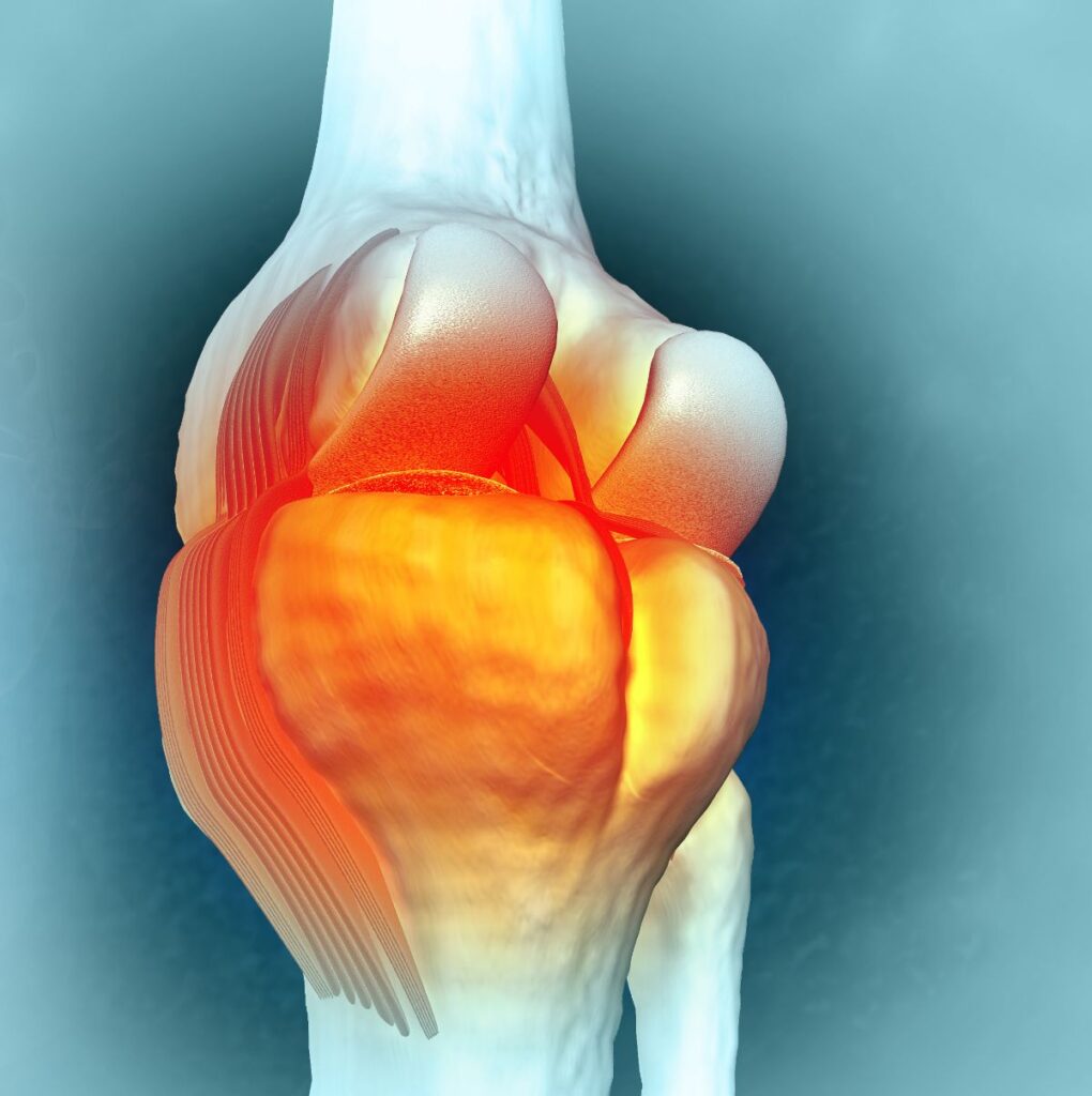 Medical Illustration: Knee