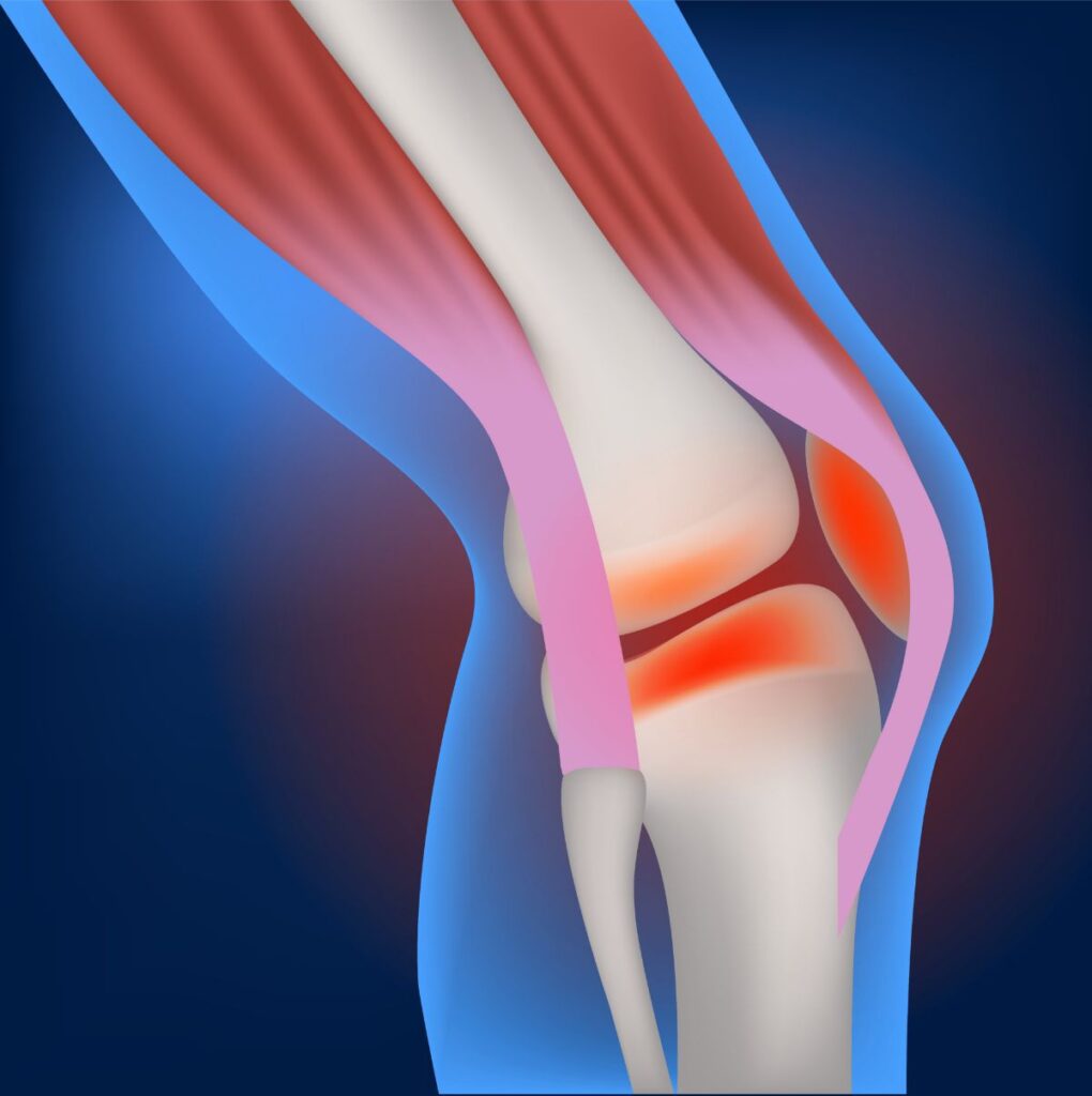 Medical Illustration: Knee