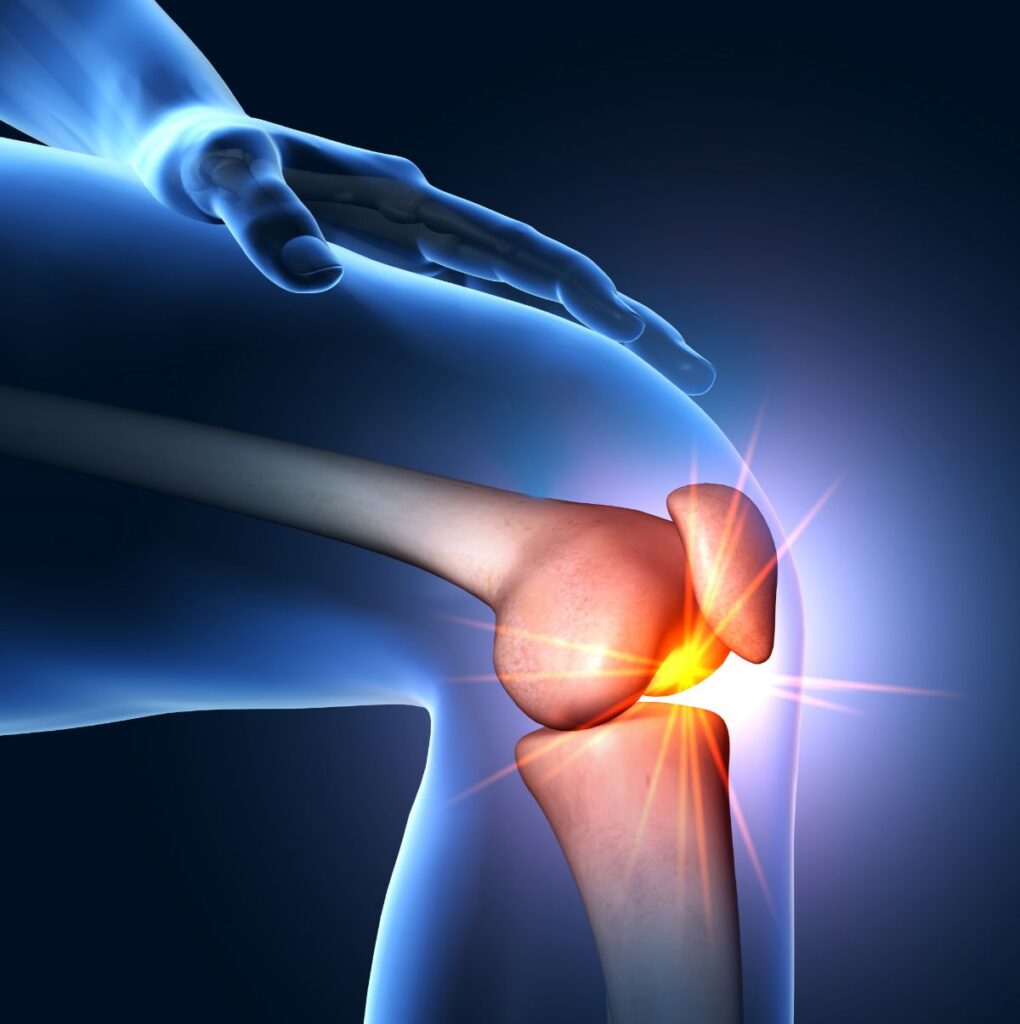 Medical Illustration: Knee