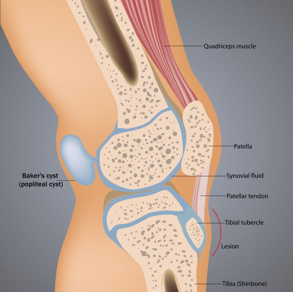 Medical Illustration: Knee