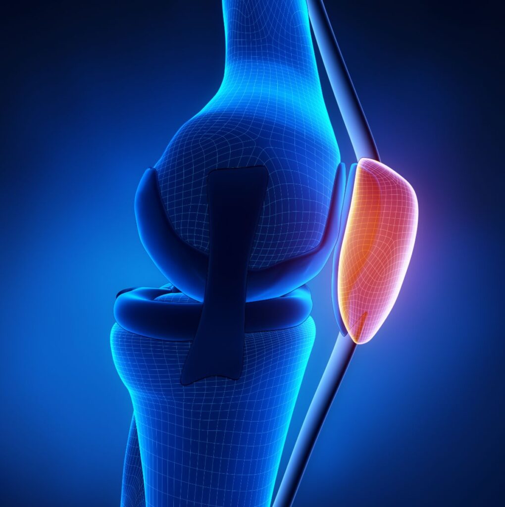 Medical Illustration: Knee