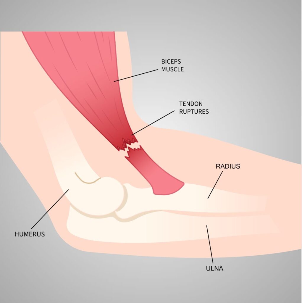 Medical Illustration Shoulder