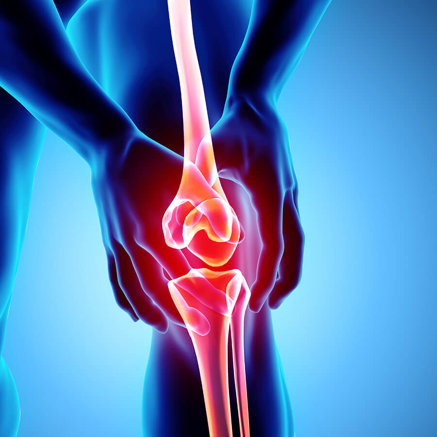 Medical illustration of knee pain