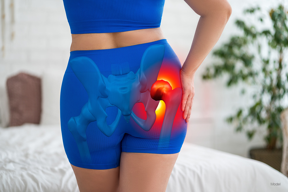 Feature Image: Do I Need a Hip Replacement? Quiz